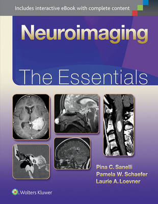 Pina C. Sanelli - Neuroimaging: The Essentials - 9781451191356 - V9781451191356