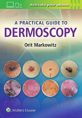 Orit Markowitz - A Practical Guide to Dermoscopy - 9781451192636 - V9781451192636