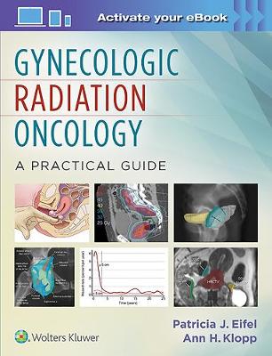 Patricia J. Eifel - Gynecologic Radiation Oncology: A Practical Guide - 9781451192650 - V9781451192650