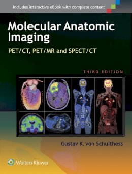 Gustav K. Von Schulthess - Molecular Anatomic Imaging: PET/CT, PET/MR and SPECT CT - 9781451192667 - V9781451192667