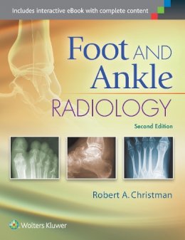 Robert Christman (Ed.) - Foot and Ankle Radiology - 9781451192834 - V9781451192834