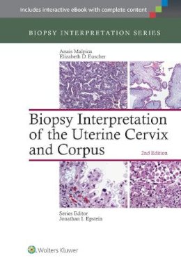 Anais Malpica - Biopsy Interpretation of the Uterine Cervix and Corpus (Biopsy Interpretation Series) - 9781451192964 - V9781451192964