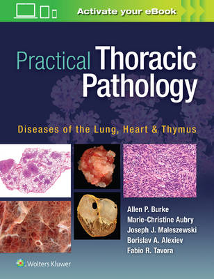 Allen P. Burke - Practical Thoracic Pathology: Diseases of the Lung, Heart, and Thymus - 9781451193510 - V9781451193510