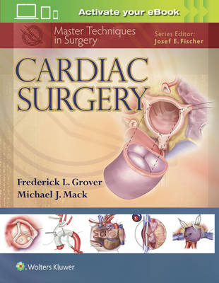 Frederick Grover - Master Techniques in Surgery: Cardiac Surgery - 9781451193534 - V9781451193534
