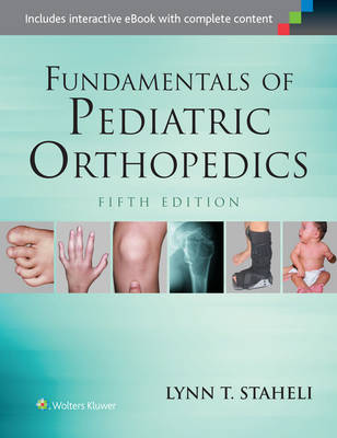 Lynn T. Staheli - Fundamentals of Pediatric Orthopedics (Staheli, Fundamentals of Pediatric Orthopedics) - 9781451193930 - V9781451193930
