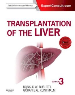 Ronald W. Busuttil - Transplantation of the Liver - 9781455702688 - V9781455702688