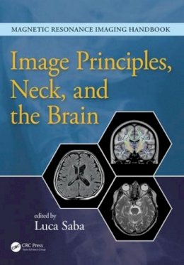 Luca Saba - Image Principles, Neck, and the Brain - 9781482216134 - V9781482216134