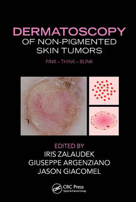 Iris Zalaudek - Dermatoscopy of Non-Pigmented Skin Tumors: Pink - Think - Blink - 9781482237528 - V9781482237528