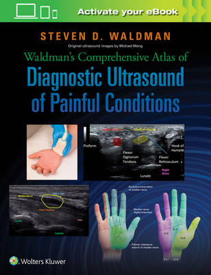 Steven Waldman - Waldman´s Comprehensive Atlas of Diagnostic Ultrasound of Painful Conditions - 9781496302892 - V9781496302892