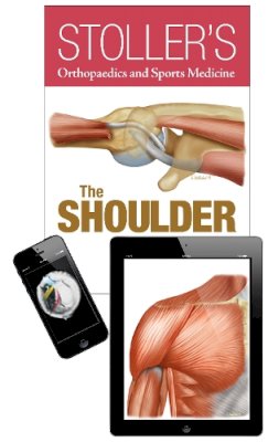David W. Stoller - Stoller´s Orthopaedics and Sports Medicine: The Shoulder Package - 9781496313331 - V9781496313331