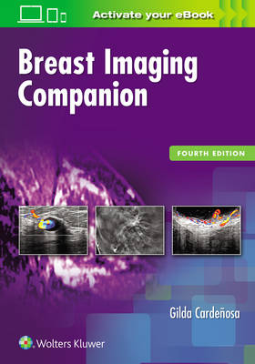 Gilda Cardenosa - Breast Imaging Companion - 9781496314963 - V9781496314963