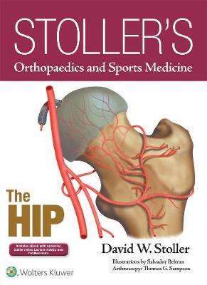 David W. Stoller - Stoller´s Orthopaedics and Sports Medicine: The Hip - 9781496317605 - V9781496317605