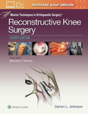 Johnson - Master Techniques in Orthopaedic Surgery: Reconstructive Knee Surgery - 9781496318275 - V9781496318275