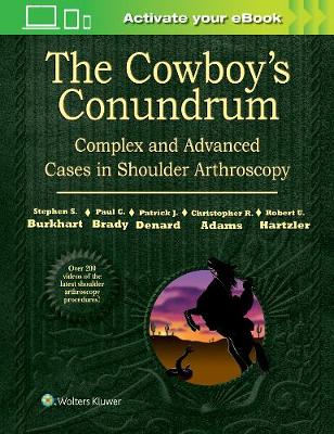 Stephen S. Burkhart - The Cowboy´s Conundrum: Complex and Advanced Cases in Shoulder Arthroscopy - 9781496318855 - V9781496318855