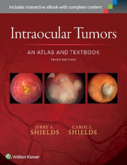 Dr. Jerry A. Shields - Intraocular Tumors: An Atlas and Textbook - 9781496321343 - V9781496321343