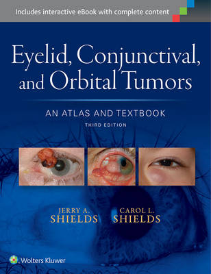 Jerry A. Shields - Eyelid, Conjunctival, and Orbital Tumors: An Atlas and Textbook - 9781496321480 - V9781496321480