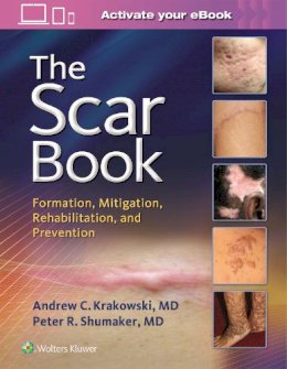 Dr. Andrew C. Krakowski - The Scar Book: Formation, Mitigation, Rehabilitation and Prevention - 9781496322388 - V9781496322388