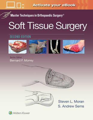 Steven L. Moran - Master Techniques in Orthopaedic Surgery: Soft Tissue Surgery - 9781496329004 - V9781496329004