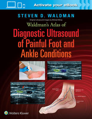Steven Waldman - Waldman´s Atlas of Diagnostic Ultrasound of Painful Foot and Ankle Conditions - 9781496345462 - V9781496345462