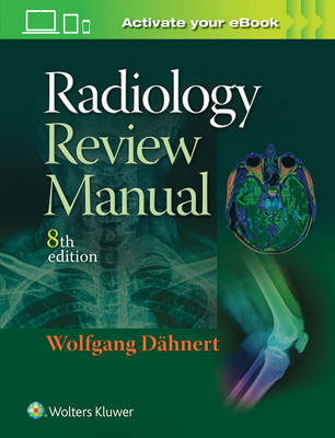 Wolfgang F. Dahnert - Radiology Review Manual - 9781496360694 - V9781496360694