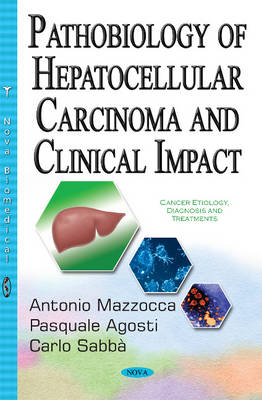 Antonio Mazzocca - Pathobiology of Hepatocellular Carcinoma & Clinical Impact - 9781536100020 - V9781536100020