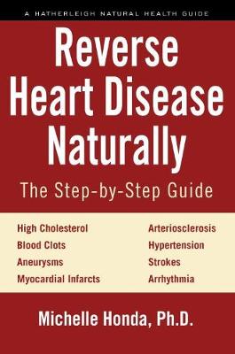 Michelle Honda - Reverse Heart Disease Naturally: Cures for high cholesterol, hypertension, arteriosclerosis, blood clots, aneurysms, myocardial infarcts and more. - 9781578266630 - V9781578266630