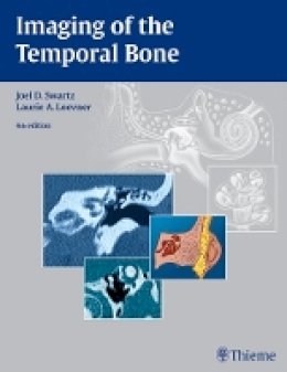 Swartz - Imaging of the Temporal Bone - 9781588903457 - V9781588903457