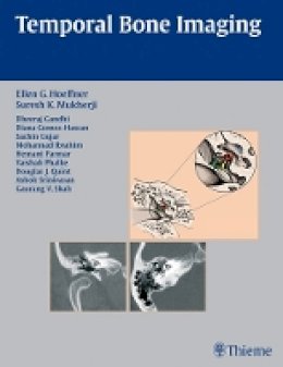 Hoeffner Et Al - Temporal Bone Imaging - 9781588904010 - V9781588904010