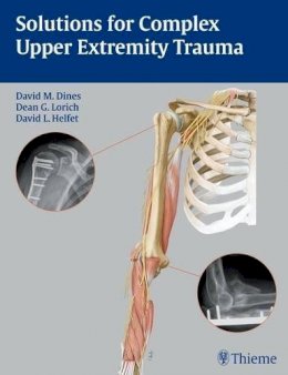 . Ed(s): Dines, David M.; Lorich, Dean G.; Helfet, David L. - Solutions for Complex Upper Extremity Trauma - 9781588905048 - V9781588905048