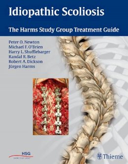 Jürgen Harms (Ed.) - Idiopathic Scoliosis: The Harms Study Group Treatment Guide - 9781604060249 - V9781604060249