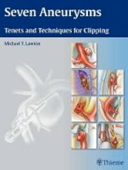 Michael Lawton - Seven Aneurysms: Tenets and Techniques for Clipping - 9781604060546 - V9781604060546