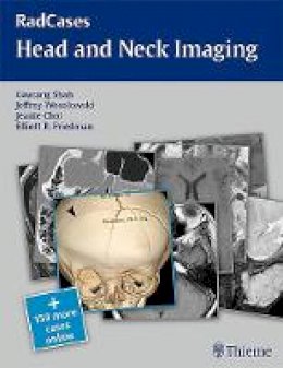 Gaurang Vrinda Shah - RadCases Head and Neck Imaging - 9781604061932 - V9781604061932