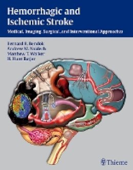 Bernard Bendok (Ed.) - Hemorrhagic and Ischemic Stroke: Medical, Imaging, Surgical and Interventional Approaches - 9781604062342 - V9781604062342