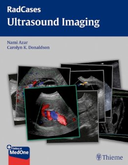 Nami R. Azar - Radcases Ultrasound Imaging - 9781604063226 - V9781604063226