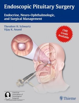 Theodore Schwartz - Endoscopic Pituitary Surgery: Endocrine, Neuro-Ophthalmologic, and Surgical Management - 9781604063479 - V9781604063479