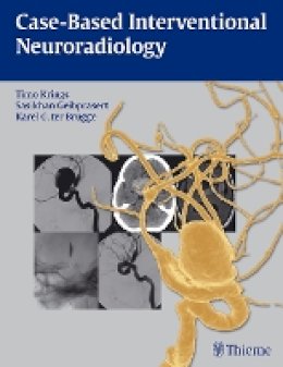 Timo Krings - Case-based Interventional Neuroradiology - 9781604063738 - V9781604063738