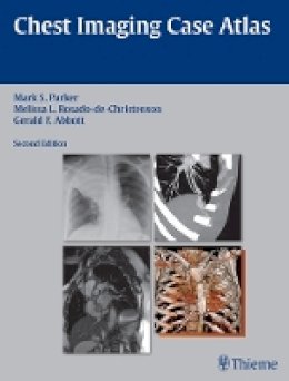 Mark S. Parker - Chest Imaging Case Atlas - 9781604065909 - V9781604065909