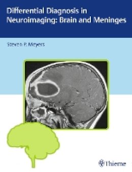 Steven P. Meyers - Differential Diagnosis in Neuroimaging: Brain and Meninges - 9781604067002 - V9781604067002