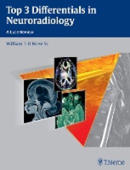 William T. O´brien - Top 3 Differentials in Neuroradiology - 9781604067231 - V9781604067231