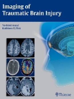 Y Anzai - Imaging of Traumatic Brain Injury - 9781604067286 - V9781604067286