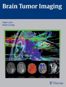 Rajan Jain - Brain Tumor Imaging - 9781604068061 - V9781604068061