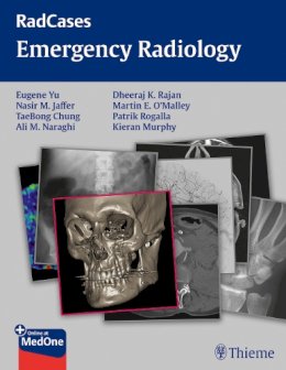 Eugene Yu - Radcases Emergency Radiology - 9781604068320 - V9781604068320