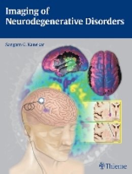 Kanekar - Imaging of Neurodegenerative Disorders - 9781604068542 - V9781604068542