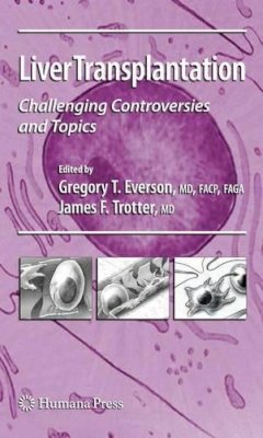 Gregory T. Everson - Liver Transplantation - 9781617377822 - V9781617377822