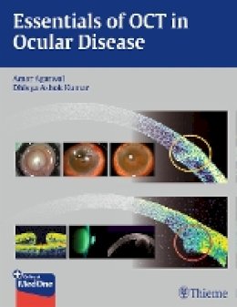 A Agarwal - Essentials of OCT in Ocular Disease - 9781626230989 - V9781626230989