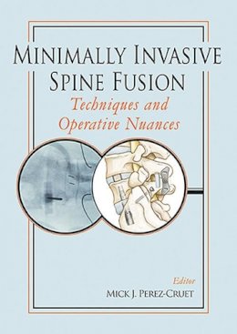Mick J. Perez-Cruet - Minimally Invasive Spine Fusion: Techniques and Operative Nuances - 9781626235694 - V9781626235694