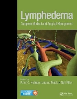 Peter C. Neligan - Lymphedema: Complete Medical and Surgical Management - 9781626236714 - V9781626236714