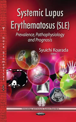 Syuichi(Ed) Koarada - Systemic Lupus Erythematosus (SLE): Prevalence, Pathophysiology & Prognosis - 9781628089905 - V9781628089905