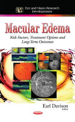 Davison E - Macular Edema: Risk Factors, Treatment Options and Long-term Outcomes - 9781633215849 - V9781633215849