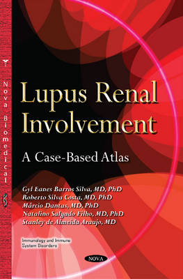 Roberto Silva Costa - Lupus Renal Involvement: A Case-based Atlas - 9781634638340 - V9781634638340